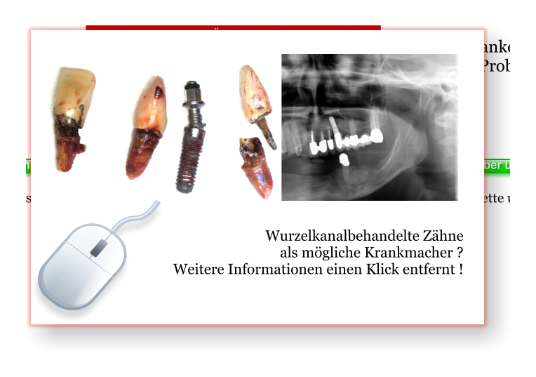 Wurzelkanalbehandelte Zähne  als mögliche Krankmacher ? Weitere Informationen einen Klick entfernt !